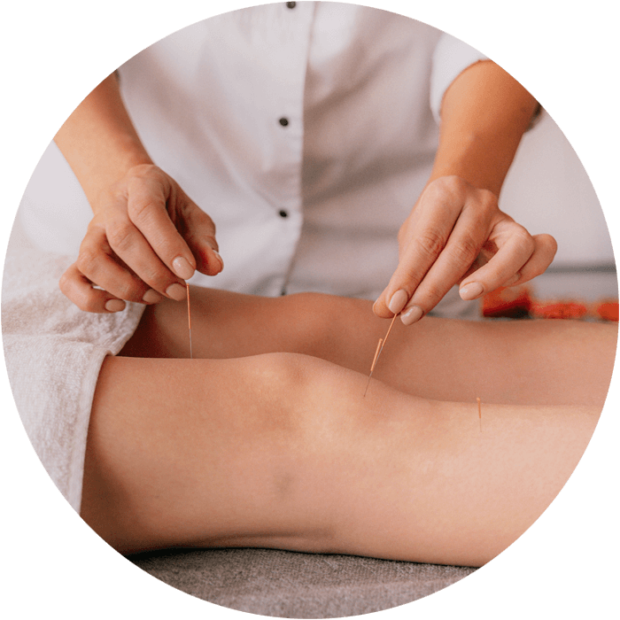 Fertility Acupuncture Near Me